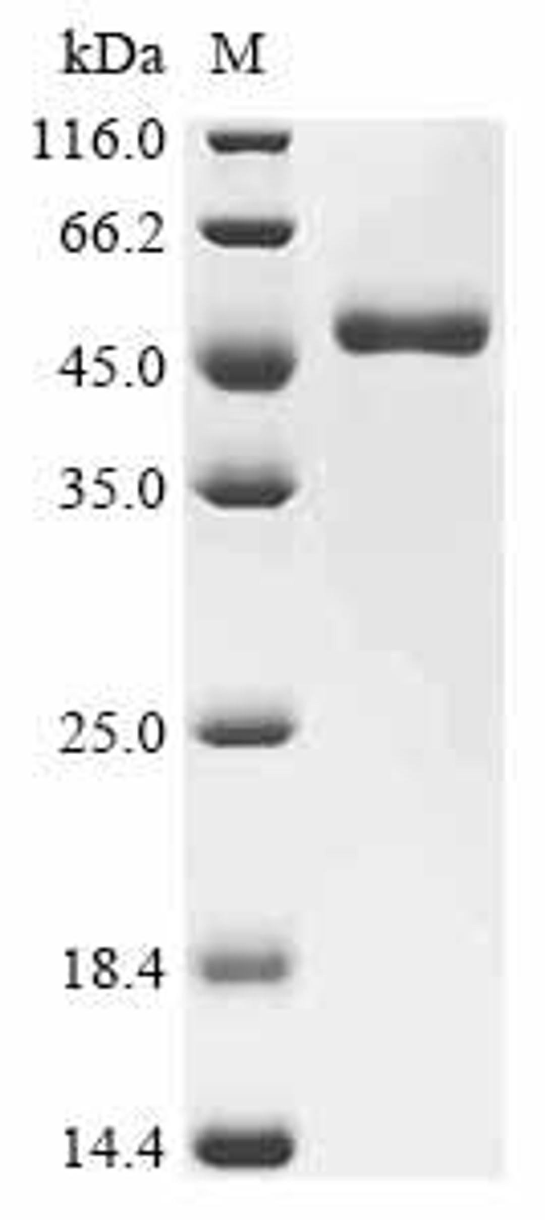 (Tris-Glycine gel) Discontinuous SDS-PAGE (reduced) with 5% enrichment gel and 15% separation gel.
