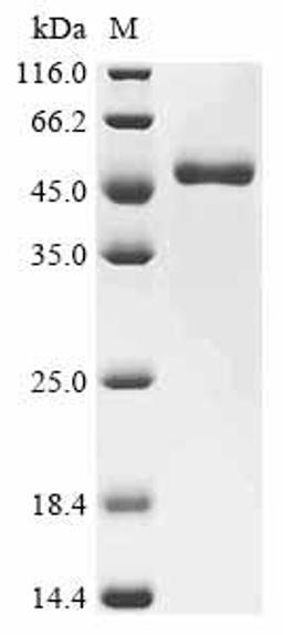 (Tris-Glycine gel) Discontinuous SDS-PAGE (reduced) with 5% enrichment gel and 15% separation gel.
