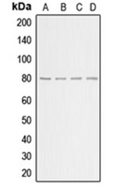 Western blot analysis of HeLa (Lane 1), HEK293T (Lane 2), NIH3T3 (Lane 3), H9C2 (Lane 4) whole cell lysates using ADRBK1 antibody