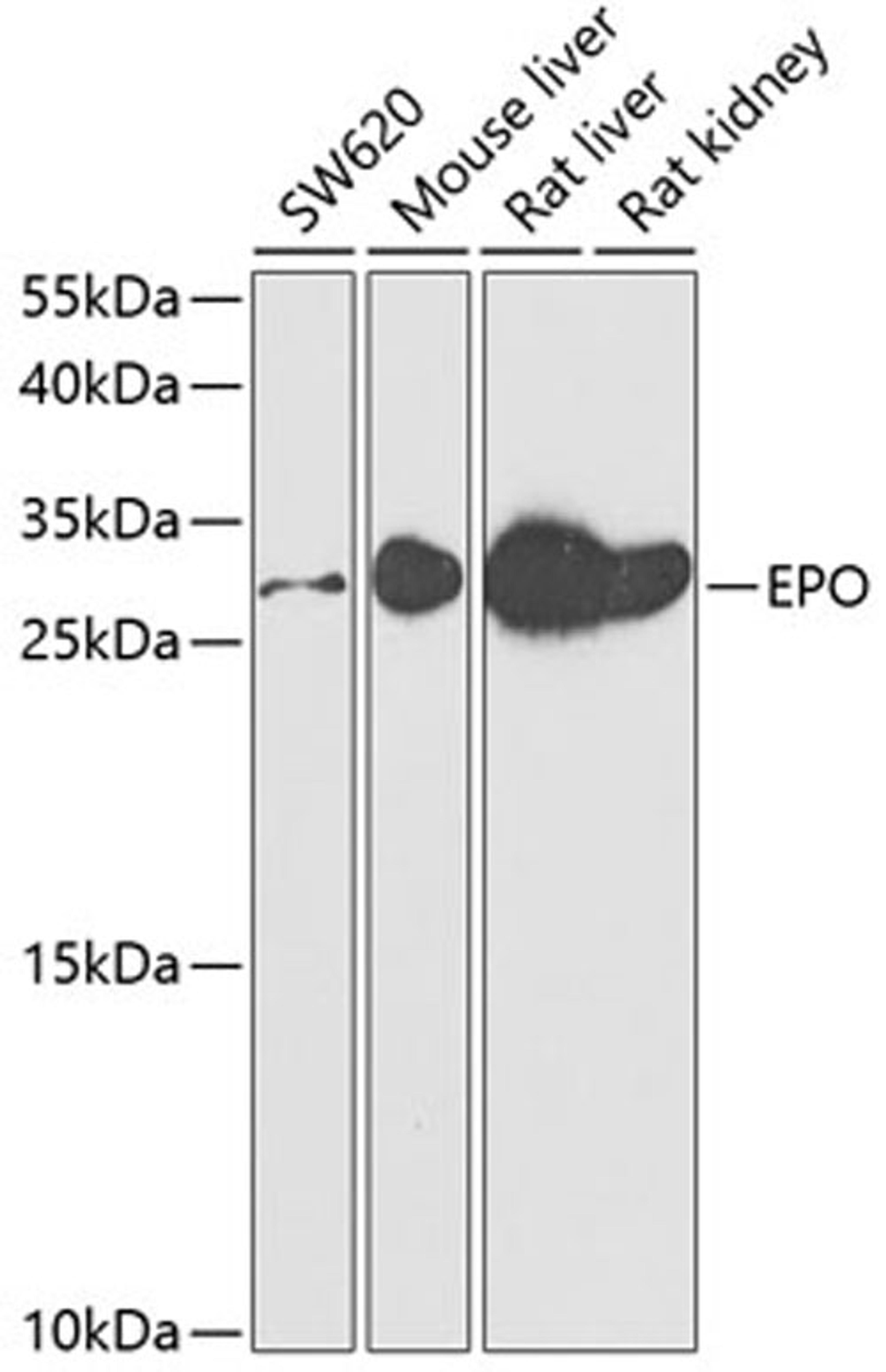 Western blot - EPO antibody (A5663)