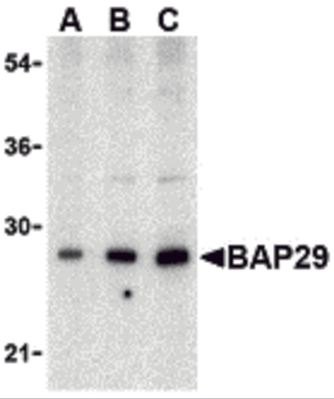 Western blot analysis of Bap29 in human heart tissue lysate with Bap29 antibody at (A) 0.5, (B) 1 and (C) 2μg/mL.
