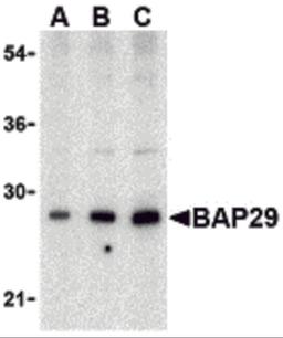 Western blot analysis of Bap29 in human heart tissue lysate with Bap29 antibody at (A) 0.5, (B) 1 and (C) 2μg/mL.
