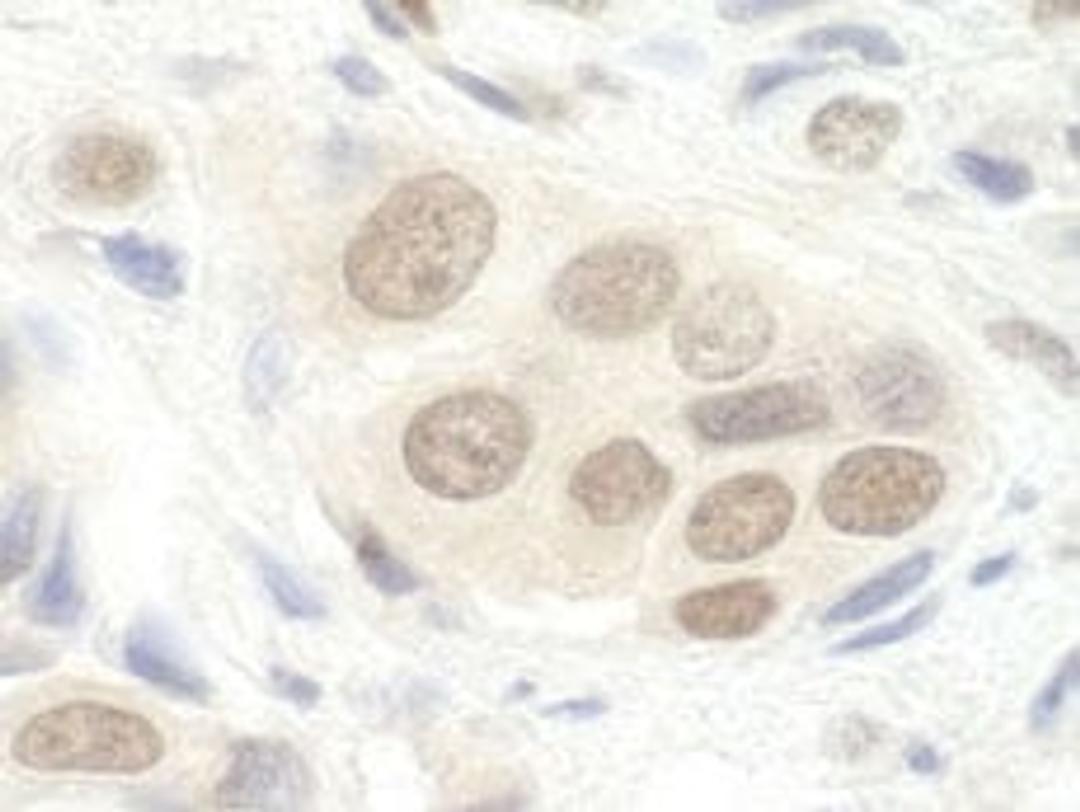 Detection of human DGCR8 by immunohistochemistry.