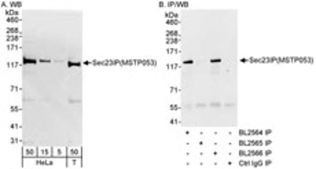 Detection of human Sec23IP(MSTP053) by western blot and immunoprecipitation.