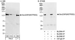 Detection of human Sec23IP(MSTP053) by western blot and immunoprecipitation.