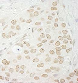 Detection of human PPP1CC by immunohistochemistry.