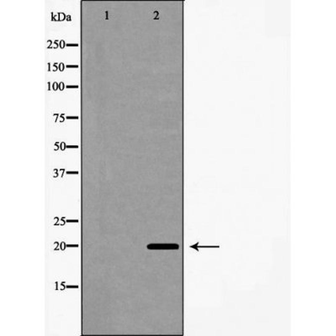 Western blot analysis of A549 cells using Interleukin 20 antibody