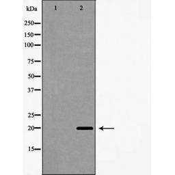 Western blot analysis of A549 cells using Interleukin 20 antibody