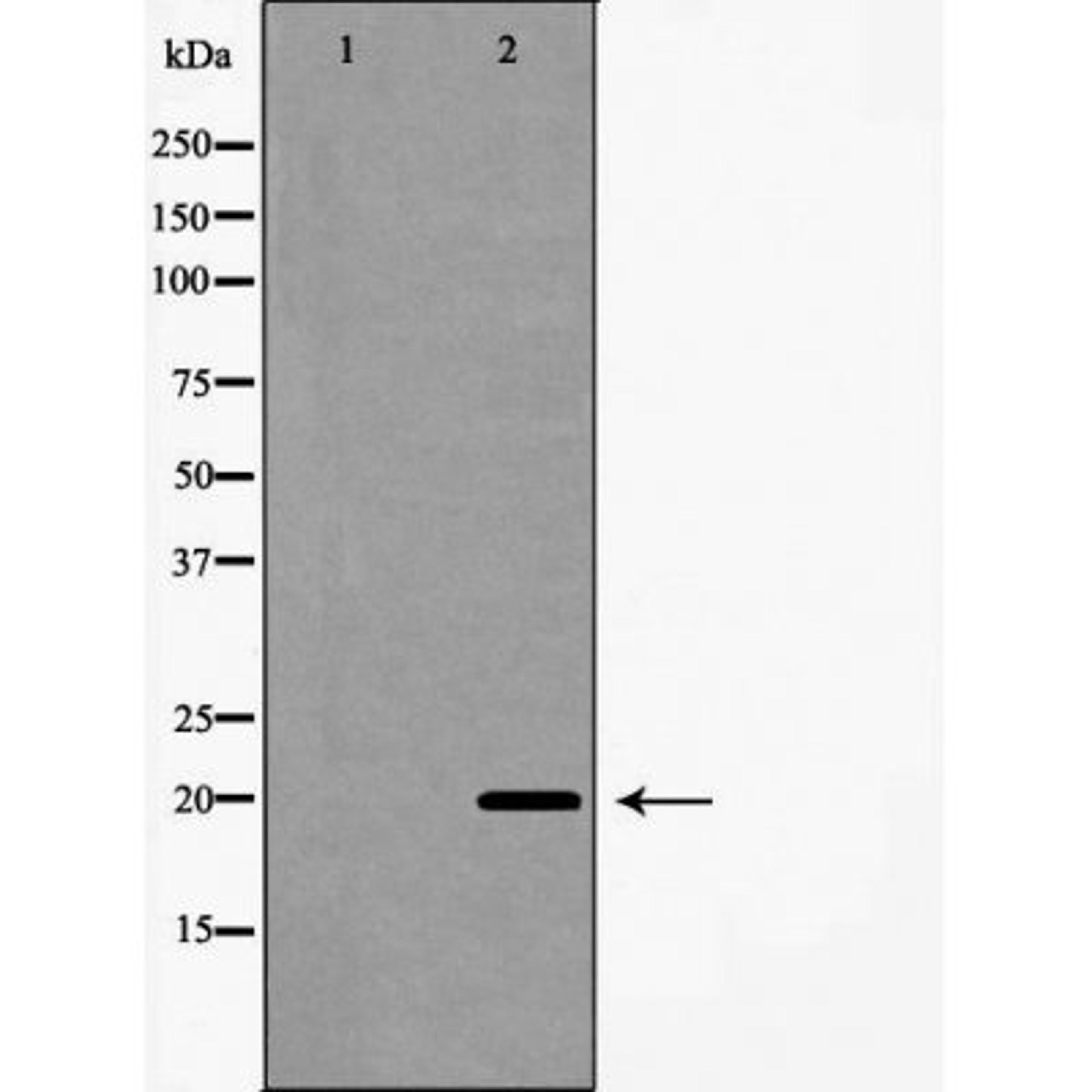 Western blot analysis of A549 cells using Interleukin 20 antibody