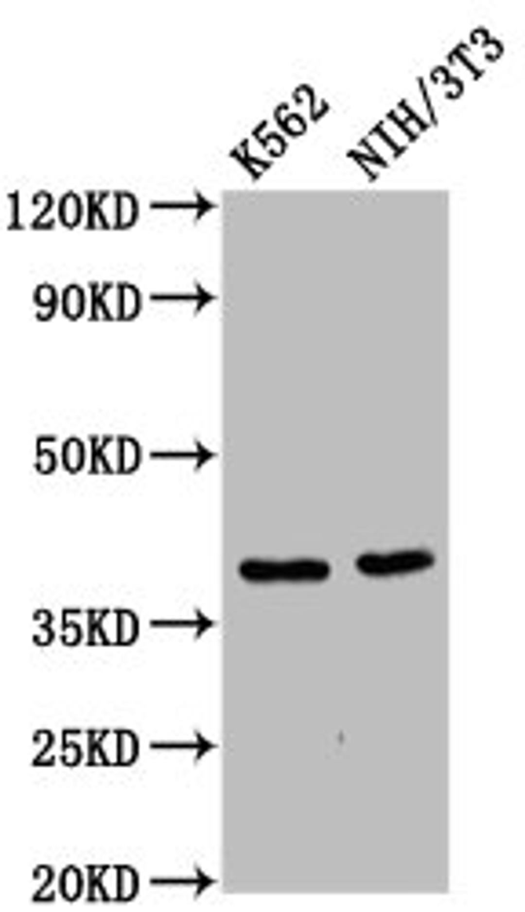 Western Blot. Positive WB detected in: K562 whole cell lysate, NIH/3T3 whole cell lysate. All lanes: ZNF367 antibody at 6µg/ml. Secondary. Goat polyclonal to rabbit IgG at 1/50000 dilution. Predicted band size: 39, 33 kDa. Observed band size: 39 kDa
