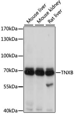 Western blot - TNXB antibody (A2535)