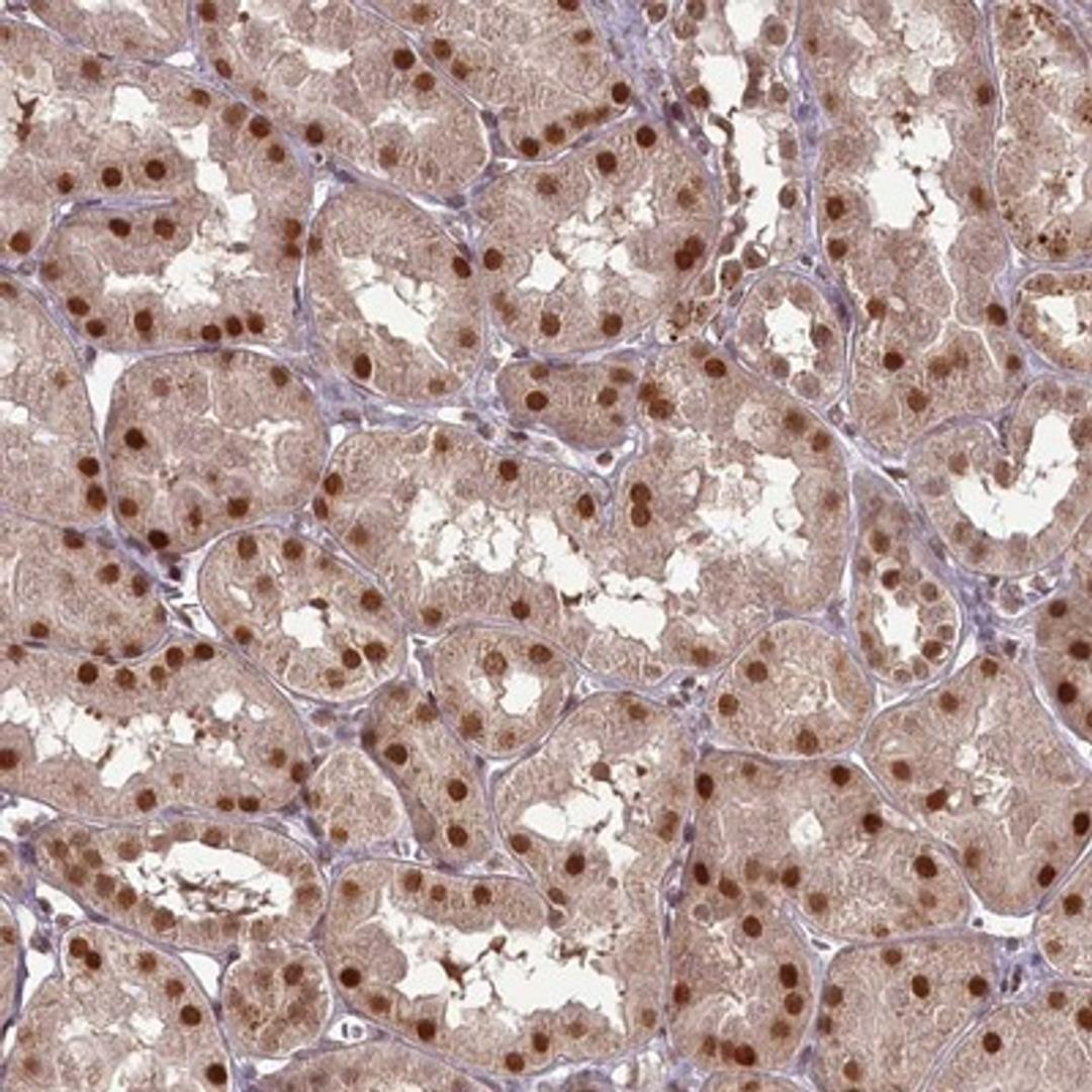 Immunohistochemistry-Paraffin: CCDC41 Antibody [NBP1-90690] - Staining of human kidney shows strong nuclear positivity in renal tubules.