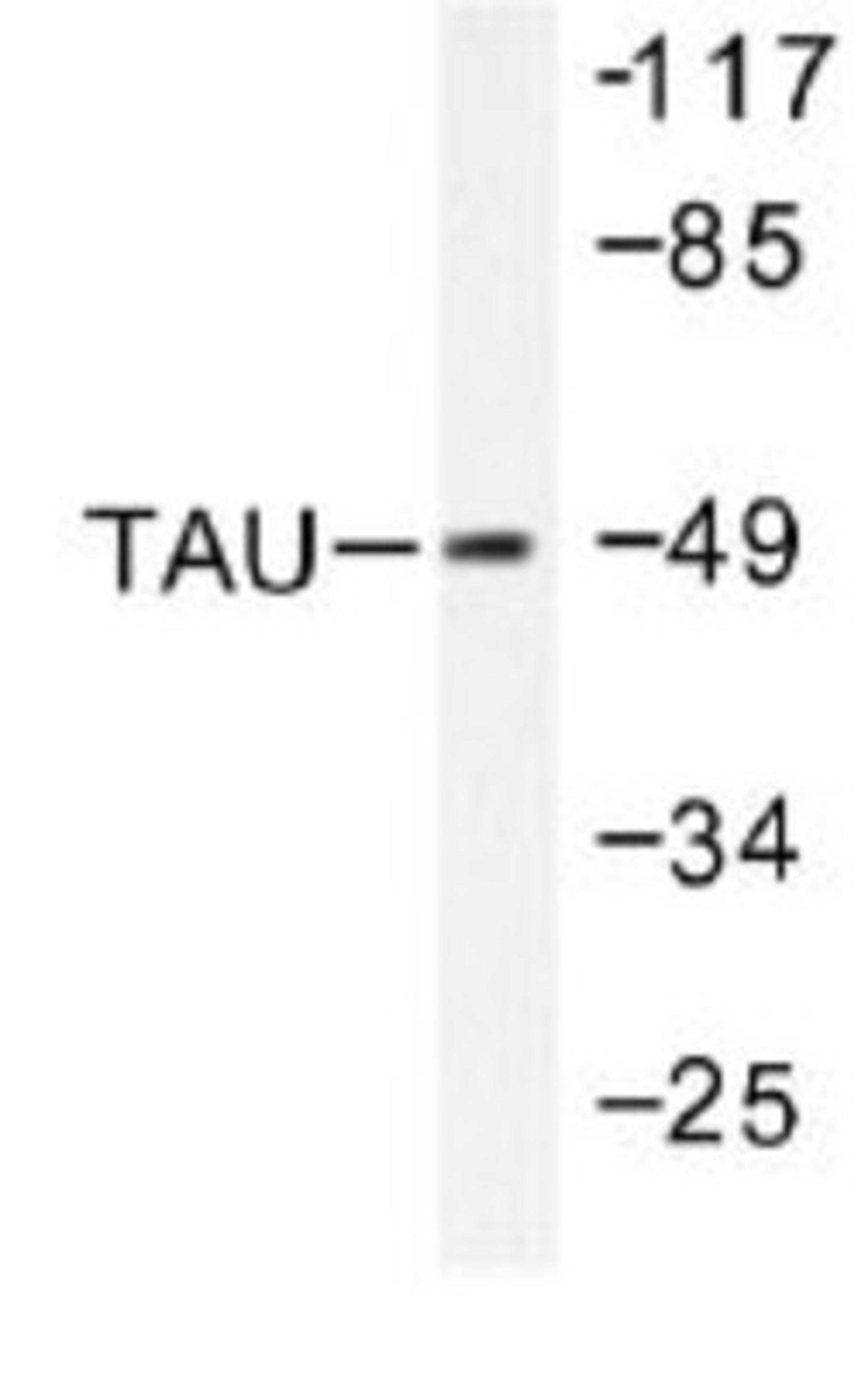 Western Blot: Tau Antibody [NB100-91989] - Western blot (WB) analysis of Tau (V256) antibody in  extracts from HeLa cells.