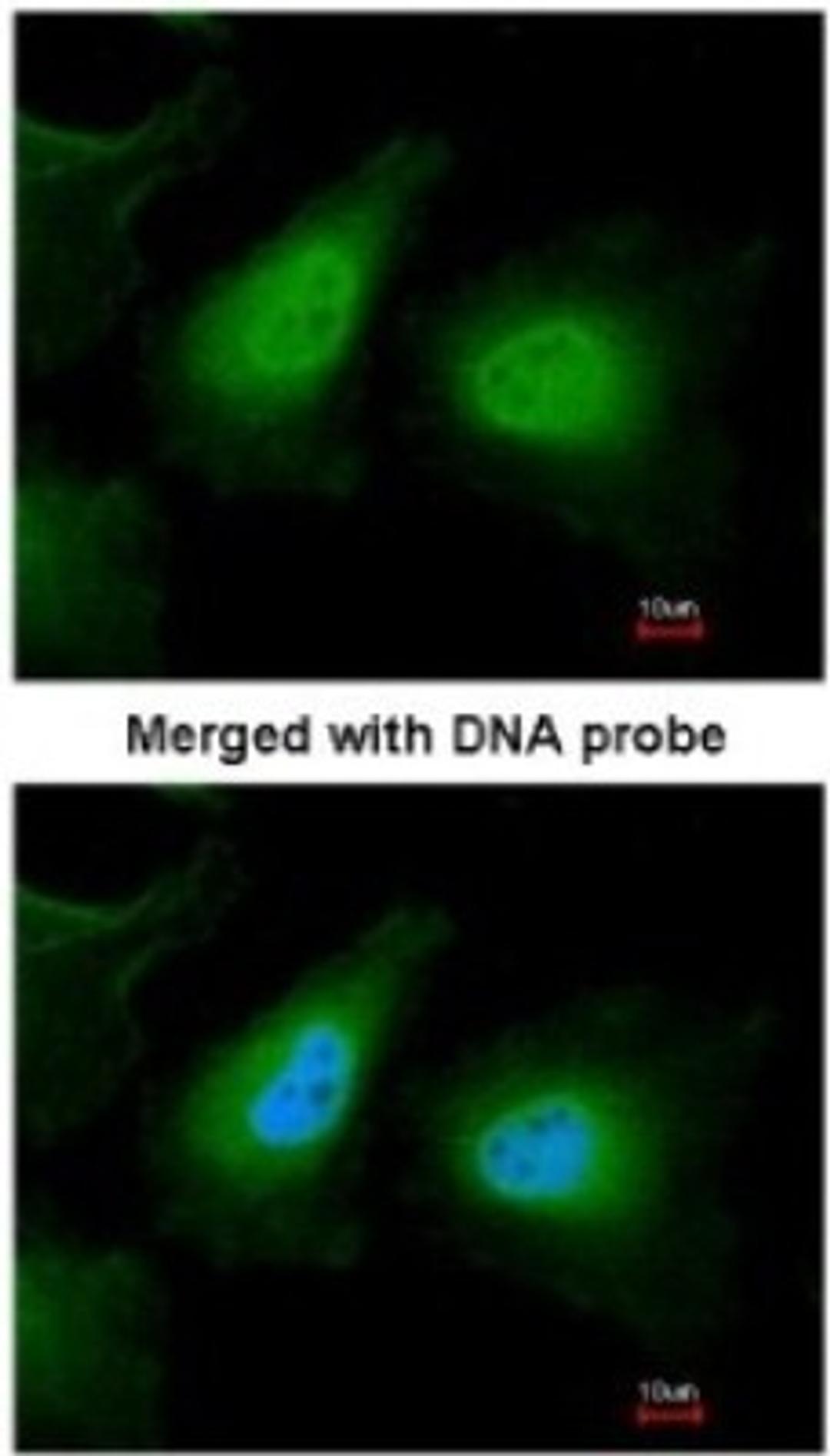 Immunocytochemistry/Immunofluorescence: ULK2 Antibody [NBP1-33136] - Paraformaldehyde-fixed HeLa, using antibody at 1:200 dilution.