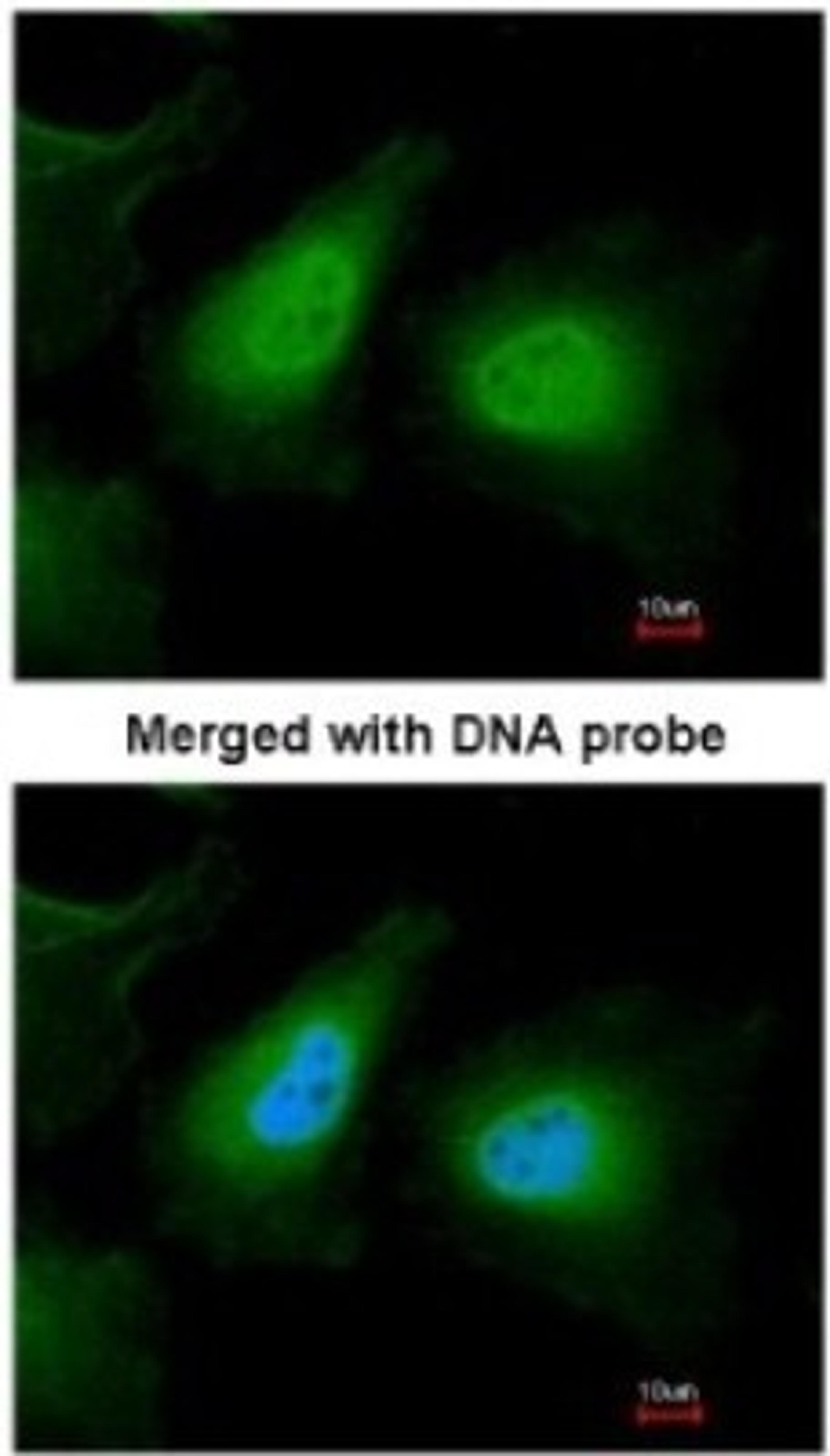 Immunocytochemistry/Immunofluorescence: ULK2 Antibody [NBP1-33136] - Paraformaldehyde-fixed HeLa, using antibody at 1:200 dilution.