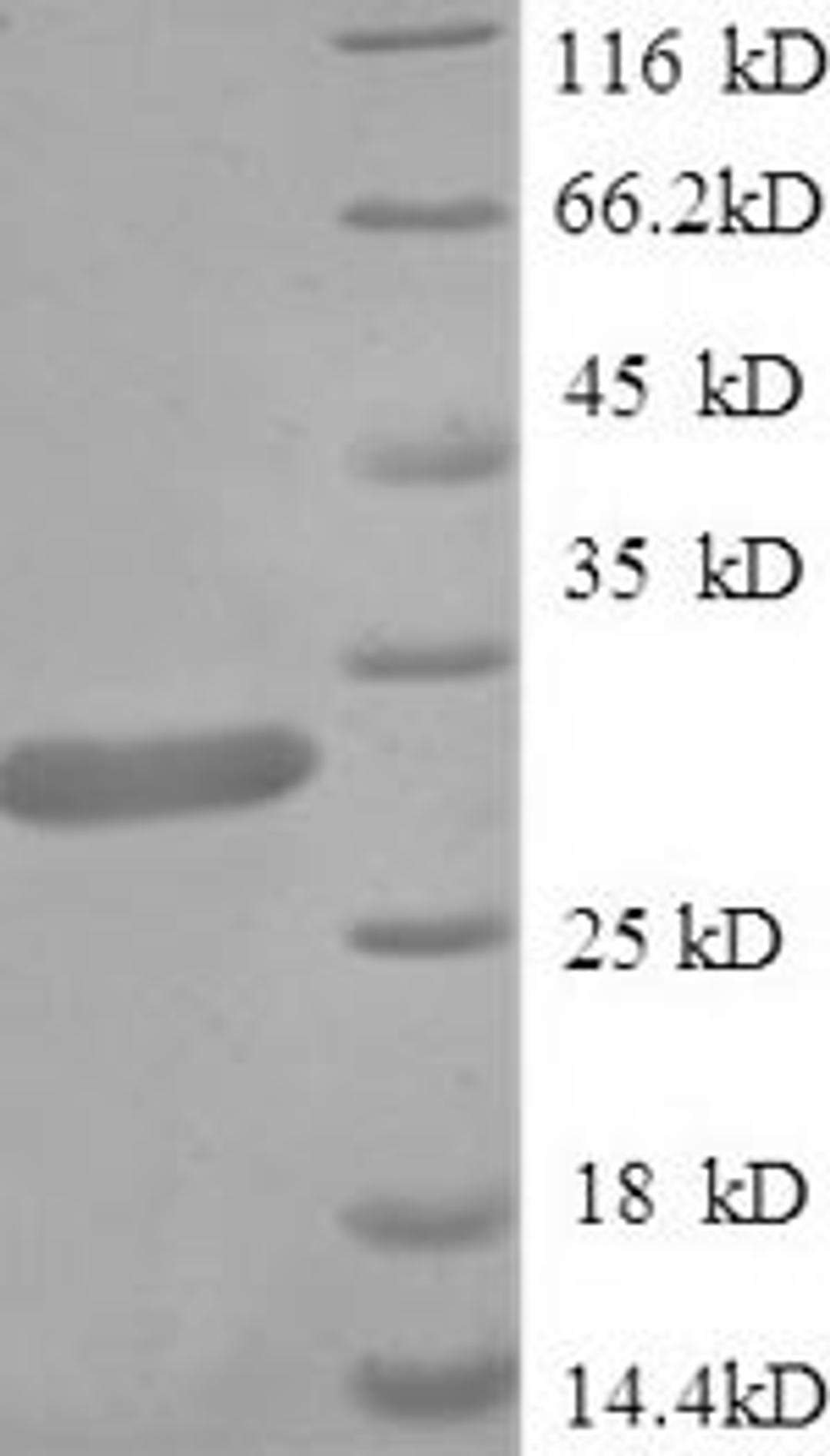 (Tris-Glycine gel) Discontinuous SDS-PAGE (reduced) with 5% enrichment gel and 15% separation gel.
