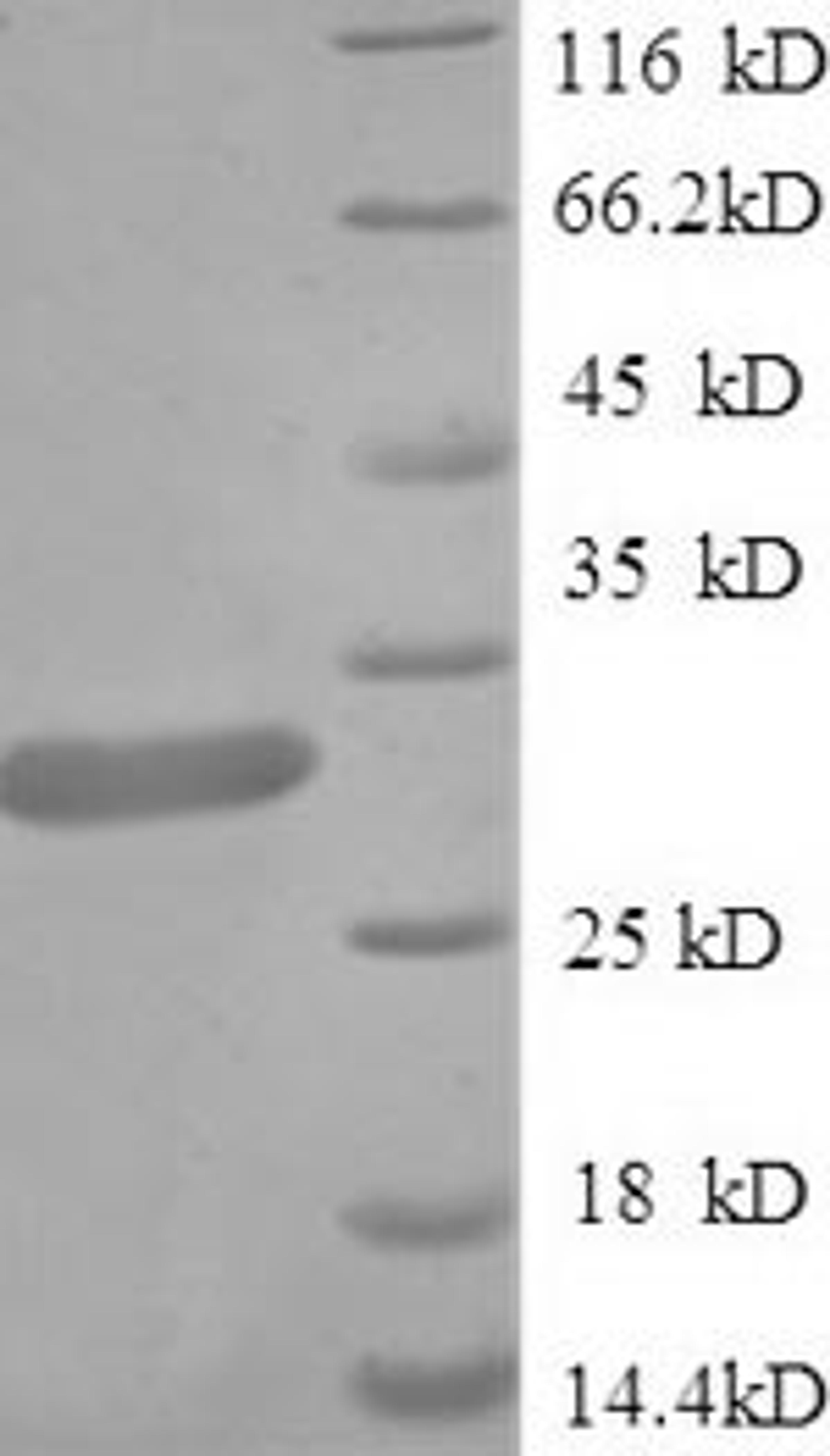 (Tris-Glycine gel) Discontinuous SDS-PAGE (reduced) with 5% enrichment gel and 15% separation gel.