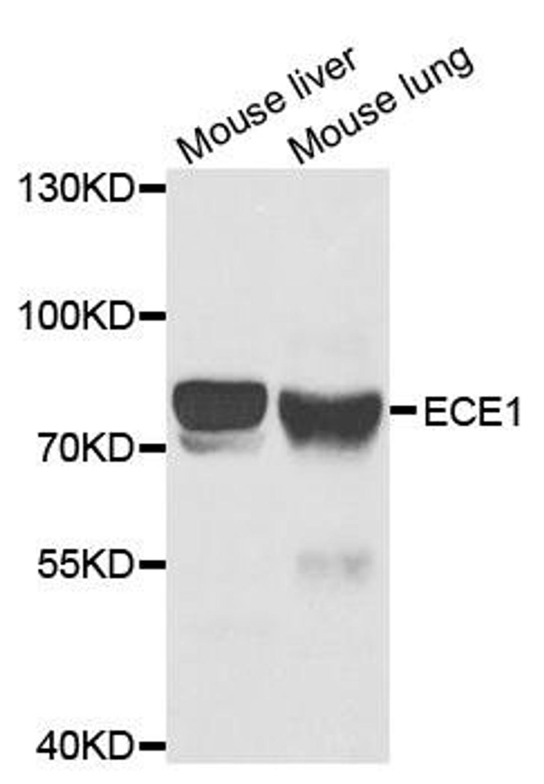 Western blot analysis of extracts of various cell lines using ECE1 antibody