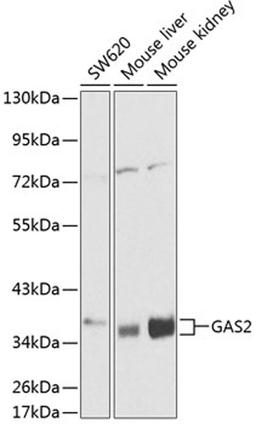 Western blot - GAS2 antibody (A1168)