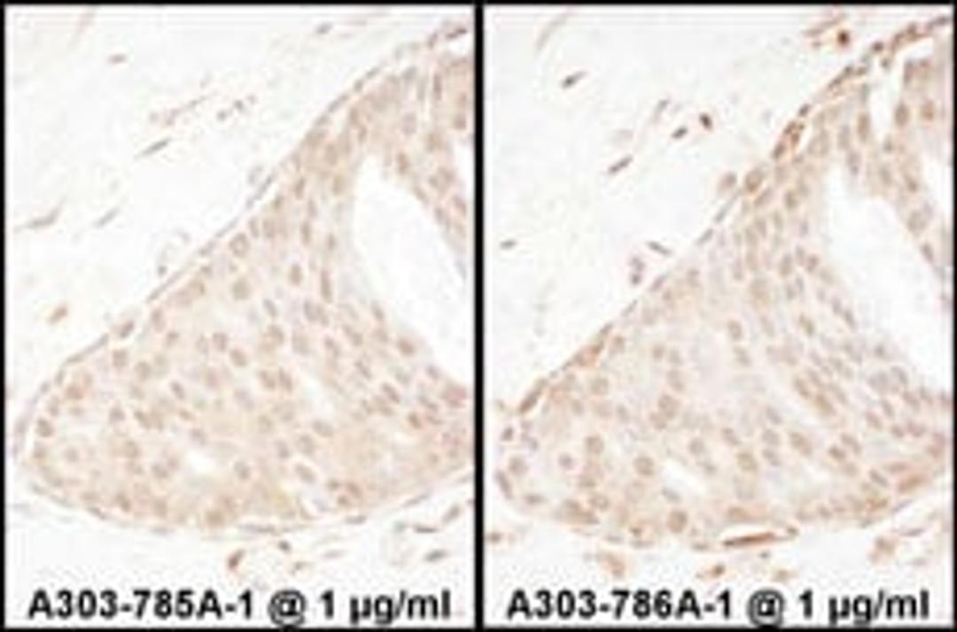 Detection of human Beta-Arrestin 2 by immunohistochemistry.