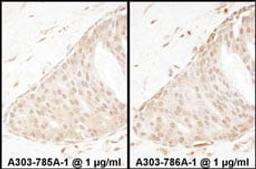 Detection of human Beta-Arrestin 2 by immunohistochemistry.