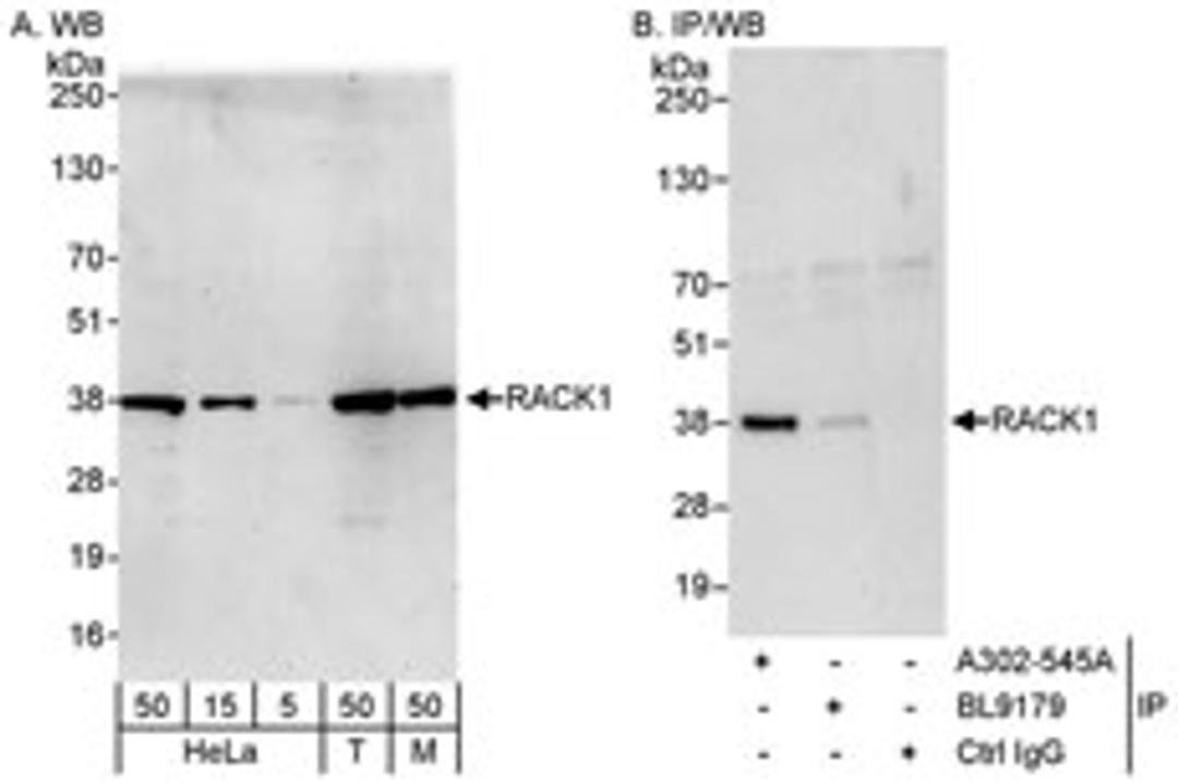 Detection of human and mouse RACK1 by western blot (h&m) and immunoprecipitation (h).