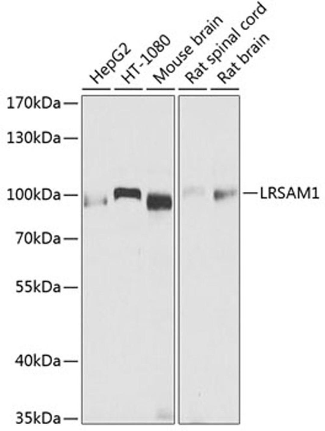 Western blot - LRSAM1 antibody (A9885)