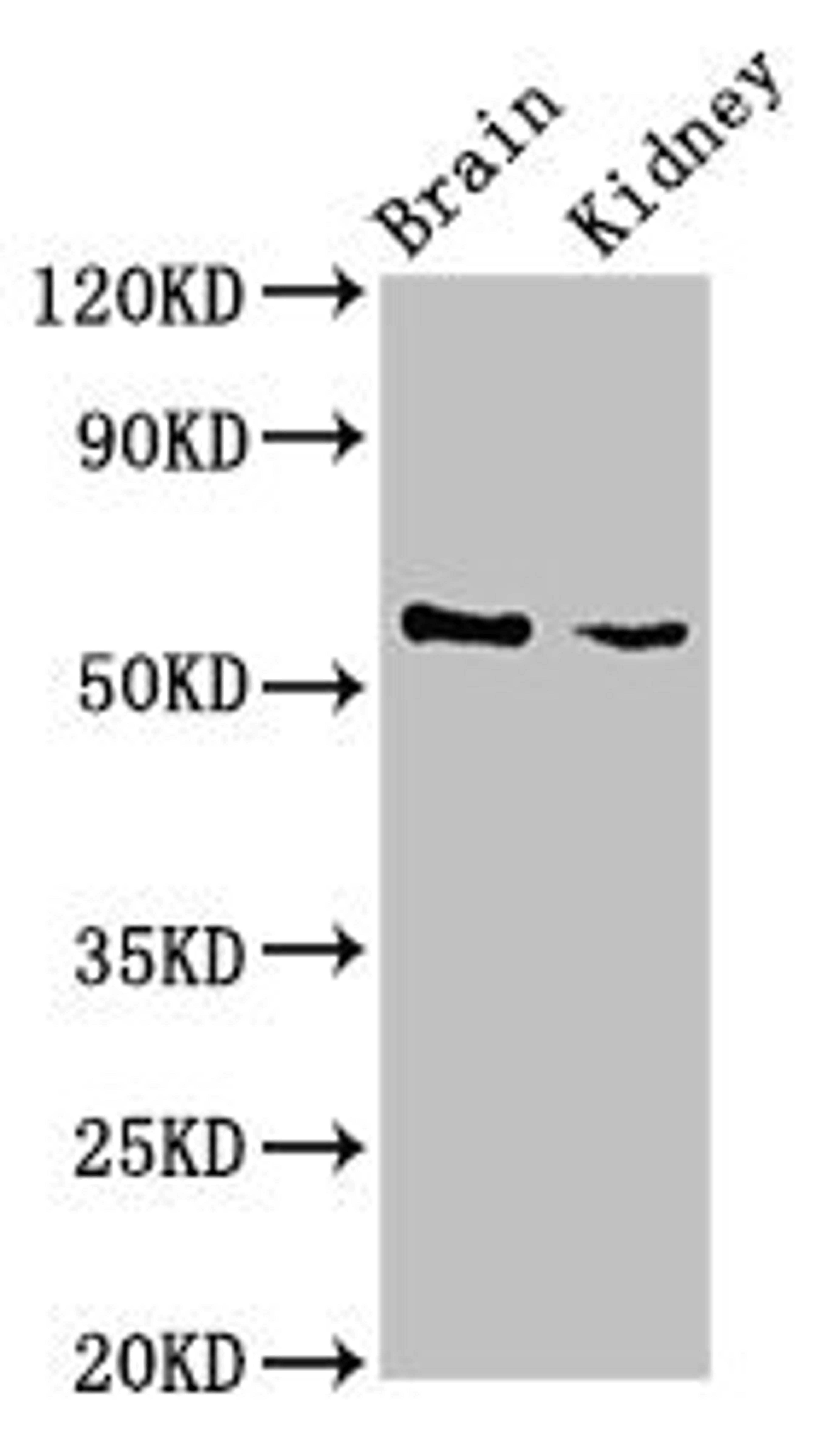 Western Blot. Positive WB detected in: Mouse brain tissue, Mouse kidney tissue. All lanes: SLC25A23 antibody at 3ug/ml. Secondary. Goat polyclonal to rabbit IgG at 1/50000 dilution. Predicted band size: 53, 50, 55, 49 kDa. Observed band size: 53 kDa.