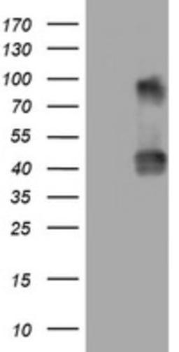 Western Blot: NEU-1/Sialidase-1 Antibody (3D4) [NBP2-46152] - Analysis of HEK293T cells were transfected with the pCMV6-ENTRY control (Left lane) or pCMV6-ENTRY NEU1.