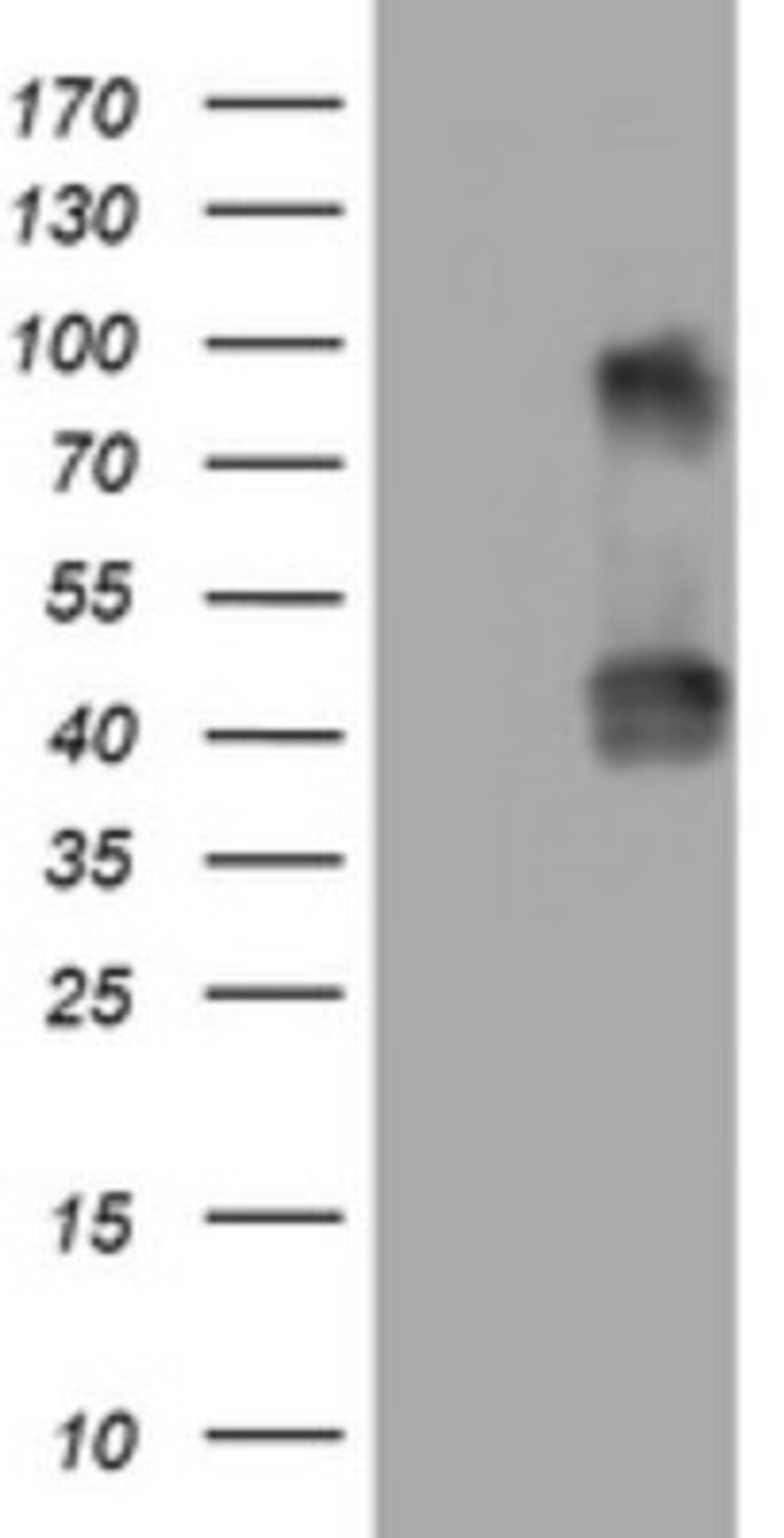 Western Blot: NEU-1/Sialidase-1 Antibody (3D4) [NBP2-46152] - Analysis of HEK293T cells were transfected with the pCMV6-ENTRY control (Left lane) or pCMV6-ENTRY NEU1.