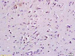 Immunohistochemical staining of rat brain tissue using NMDAR2B (phospho-Tyr125) antibody.