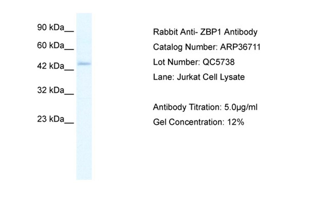 Antibody used in WB on Human HepG2 at 5.0 ug/ml.