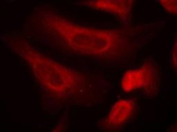 Immunocytochemistry/Immunofluorescence: STAT1 [p Ser727] Antibody [NB100-82209] - Staining of methanol-fixed Hela cells using STAT1(Phospho-Ser727) antibody.