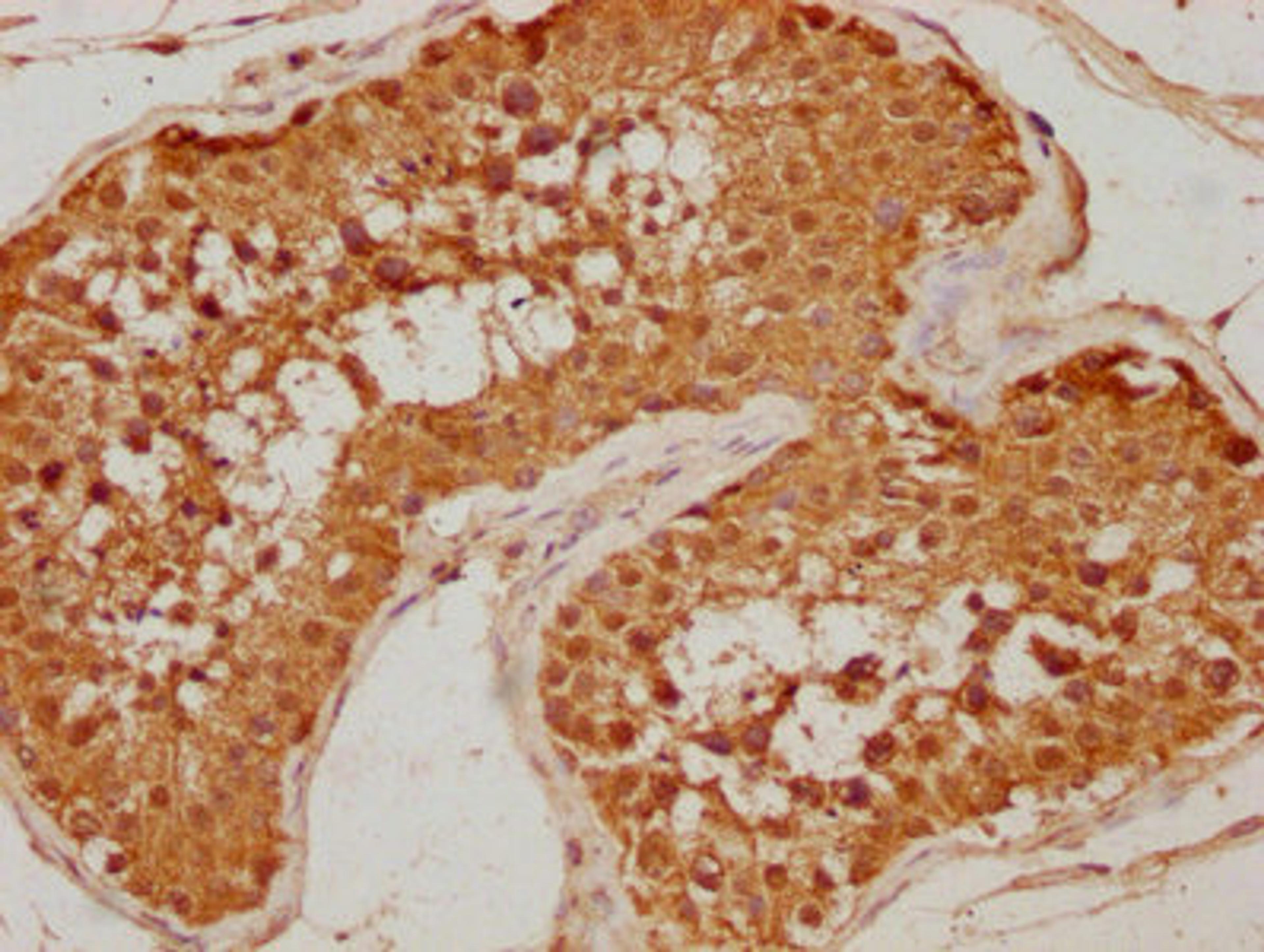 IHC image of CSB-PA007570OA01HU diluted at 1:500 and staining in paraffin-embedded human testis tissue performed on a Leica BondTM system. After dewaxing and hydration, antigen retrieval was mediated by high pressure in a citrate buffer (pH 6.0). Section was blocked with 10% normal goat serum 30min at RT. Then primary antibody (1% BSA) was incubated at 4°C overnight. The primary is detected by a biotinylated secondary antibody and visualized using an HRP conjugated SP system.