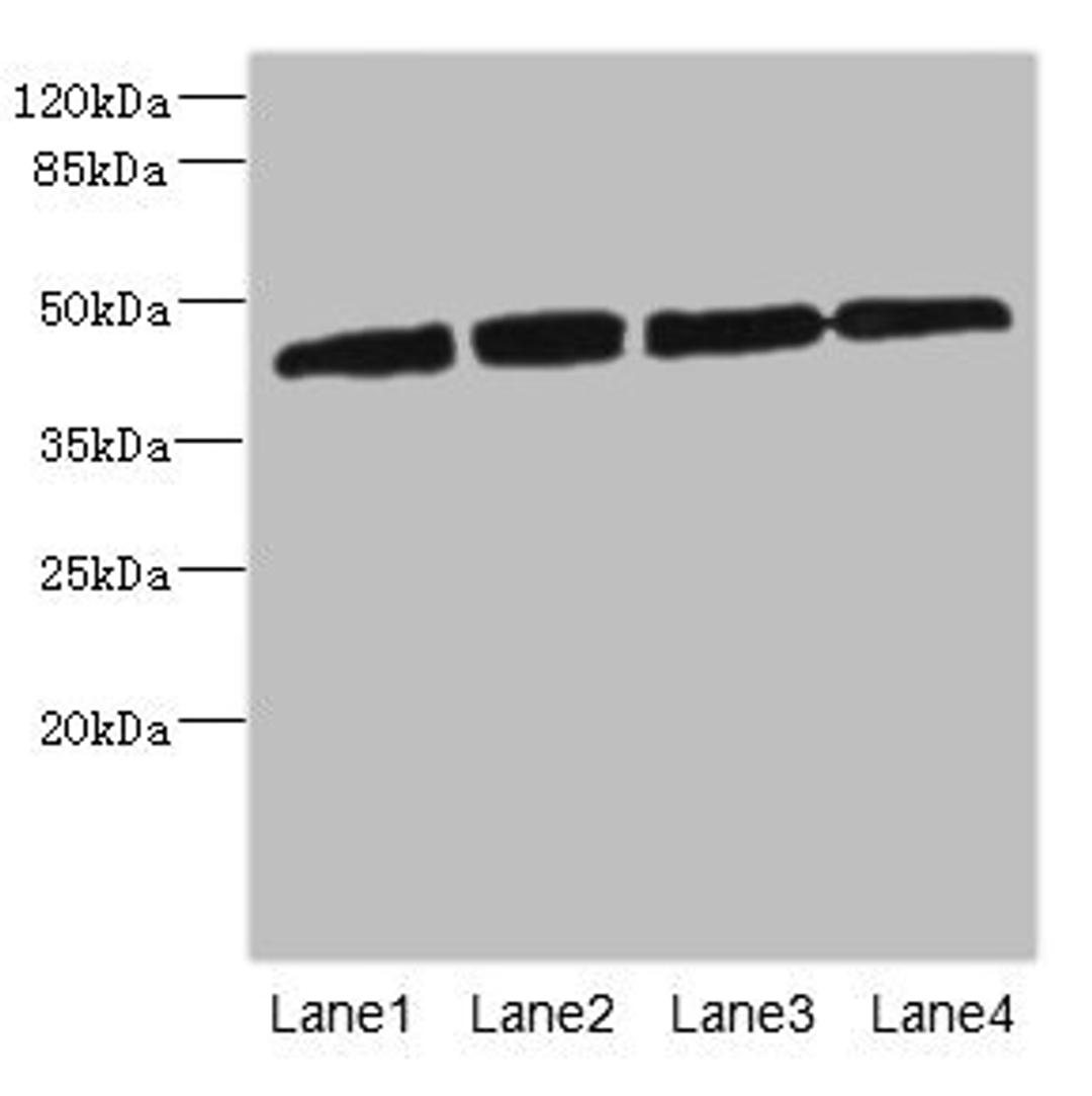 Western blot. All lanes: PRKAR1B antibody at 2.66ug/ml. Lane 1: HepG2 whole cell lysate. Lane 2: Jurkat whole cell lysate. Lane 3: 293T whole cell lysate. Lane 4: Hela whole cell lysate. Secondary. Goat polyclonal to rabbit IgG at 1/10000 dilution. Predicted band size: 43 kDa. Observed band size: 43 kDa.