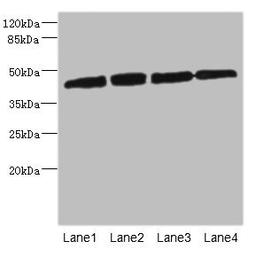 Western blot. All lanes: PRKAR1B antibody at 2.66ug/ml. Lane 1: HepG2 whole cell lysate. Lane 2: Jurkat whole cell lysate. Lane 3: 293T whole cell lysate. Lane 4: Hela whole cell lysate. Secondary. Goat polyclonal to rabbit IgG at 1/10000 dilution. Predicted band size: 43 kDa. Observed band size: 43 kDa.