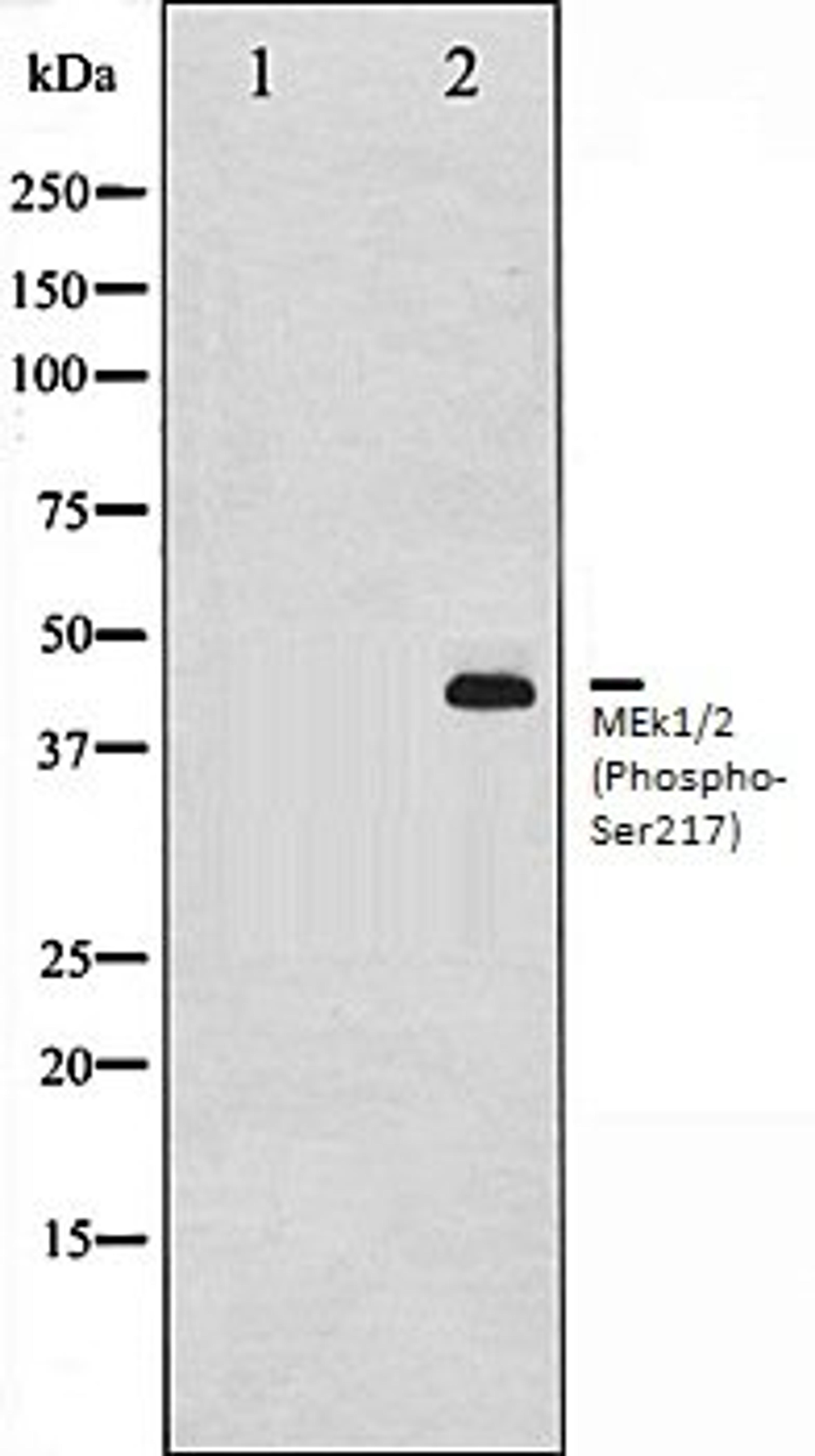 Western blot analysis of 293 whole cell lysates using MEK1/2 (Phospho-Ser217) antibody, The lane on the left is treated with the antigen-specific peptide.