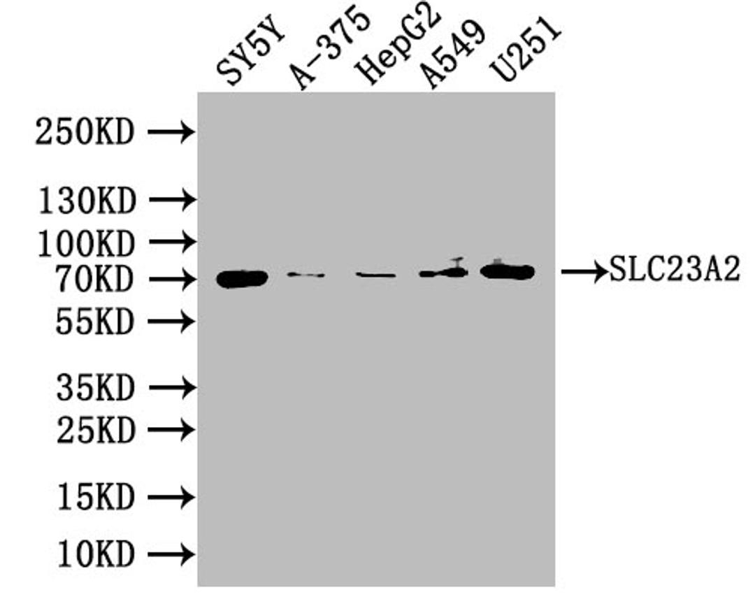 Western blot. All lanes: SLC23A2antibody at 3.16ug/ml. Lane 1: SH-SY5Y whole cell lysate. Lane 2: A375 whole cell lysate. Secondary. Goat polyclonal to rabbit IgG at 1/10000 dilution. Predicted band size: 71, 59 kDa. Observed band size: 71 kDa. 