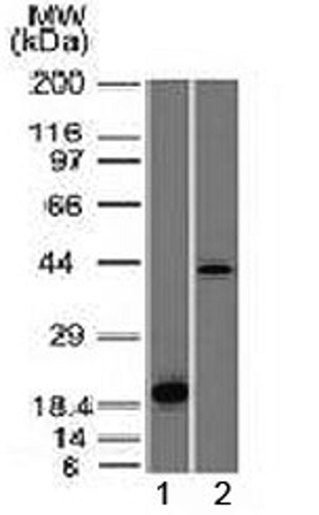 Western blot testing of 1) a partial recombinant protein and 2) human liver lysate with Aurora B antibody (clone AURKB/1521). Predicted molecular weight: 39-45 kDa