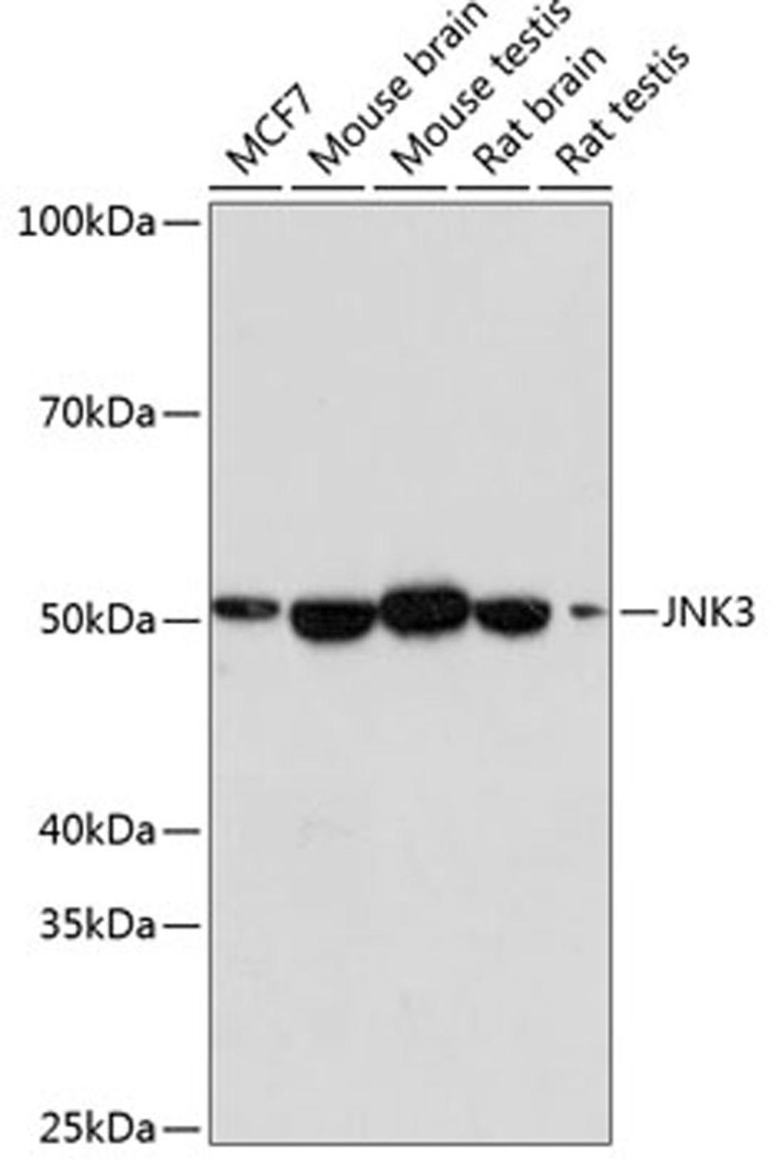 Western blot - JNK3 antibody (A19075)