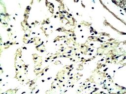 IHC-P of neural cilia of human colon cancer tissue (Cd304/Bdca-4/Nrp-1antibody at 1:200)