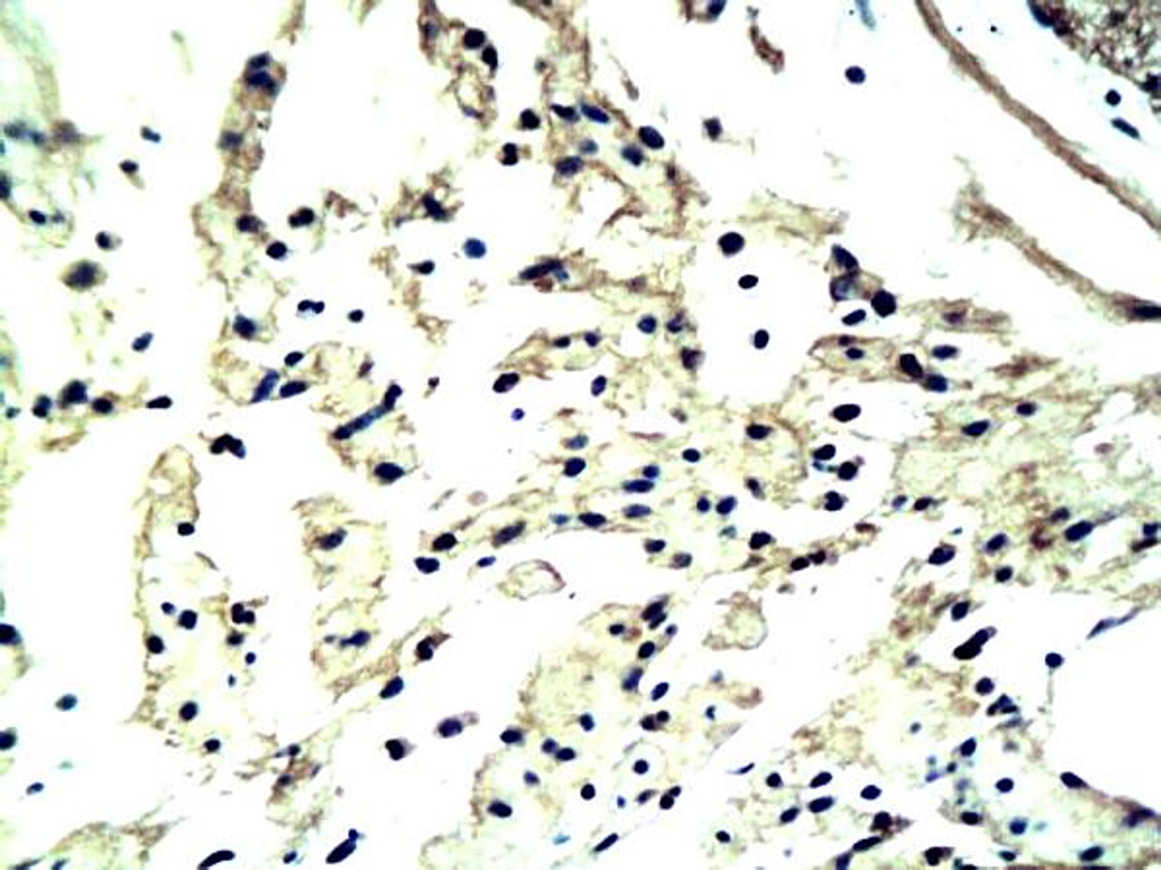 IHC-P of neural cilia of human colon cancer tissue (Cd304/Bdca-4/Nrp-1antibody at 1:200)