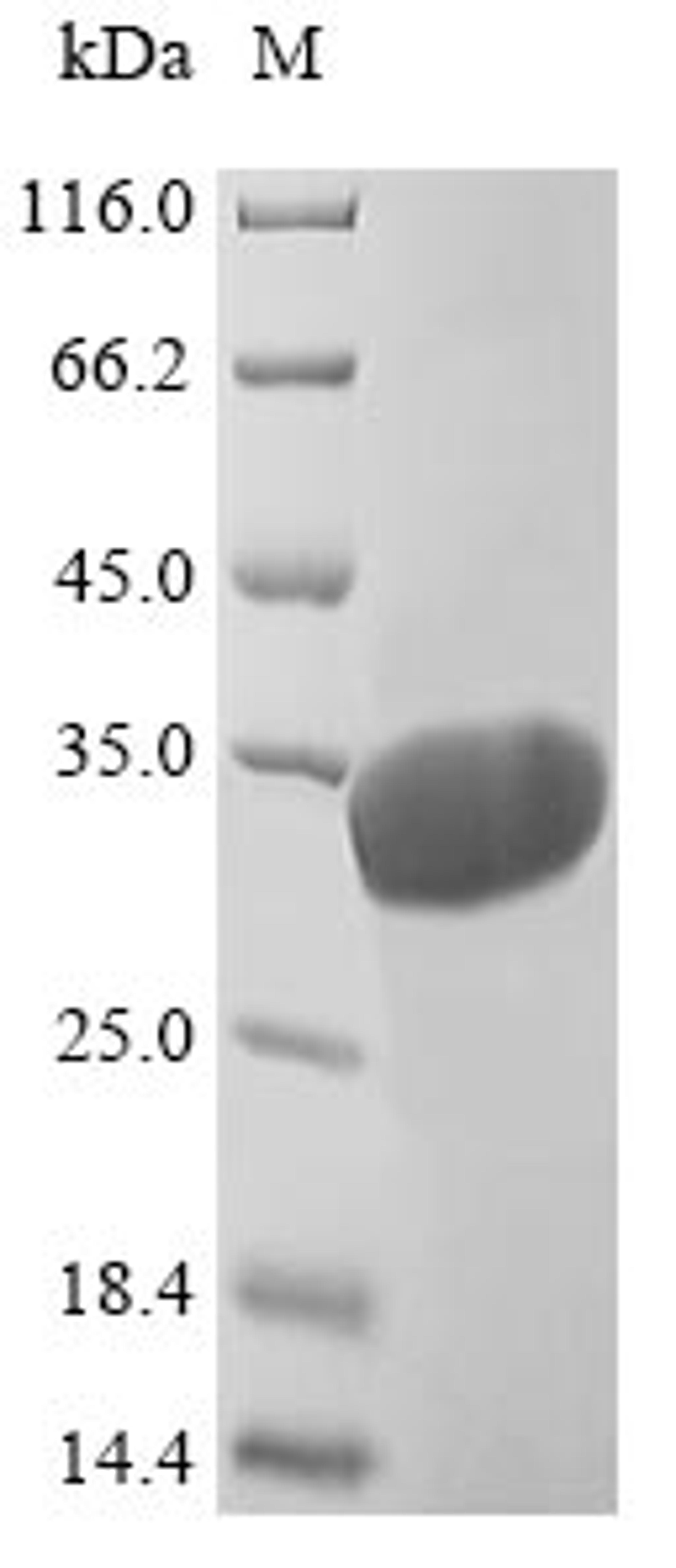 (Tris-Glycine gel) Discontinuous SDS-PAGE (reduced) with 5% enrichment gel and 15% separation gel.
