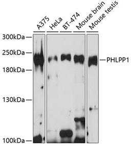 Western blot - PHLPP1 antibody (A9542)