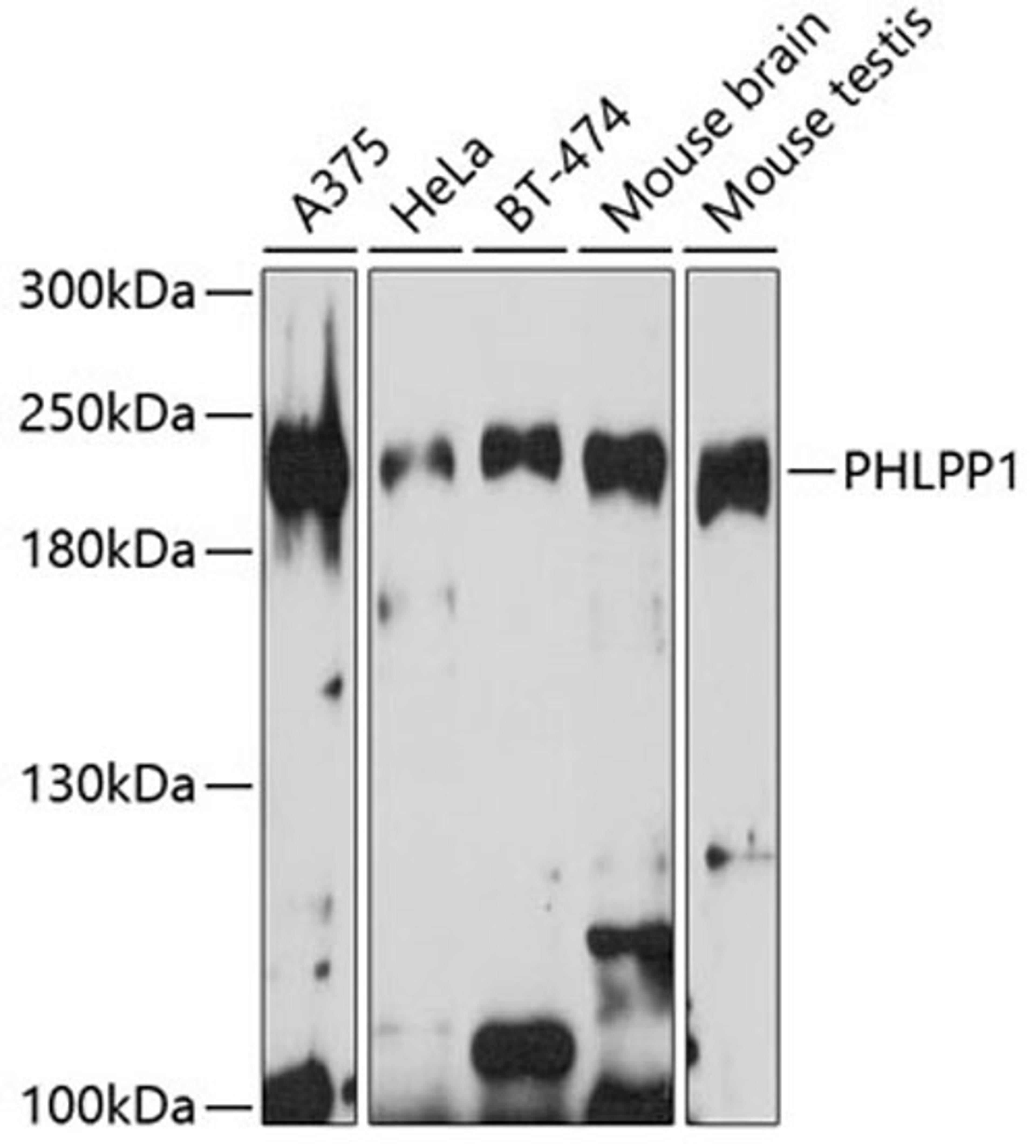 Western blot - PHLPP1 antibody (A9542)