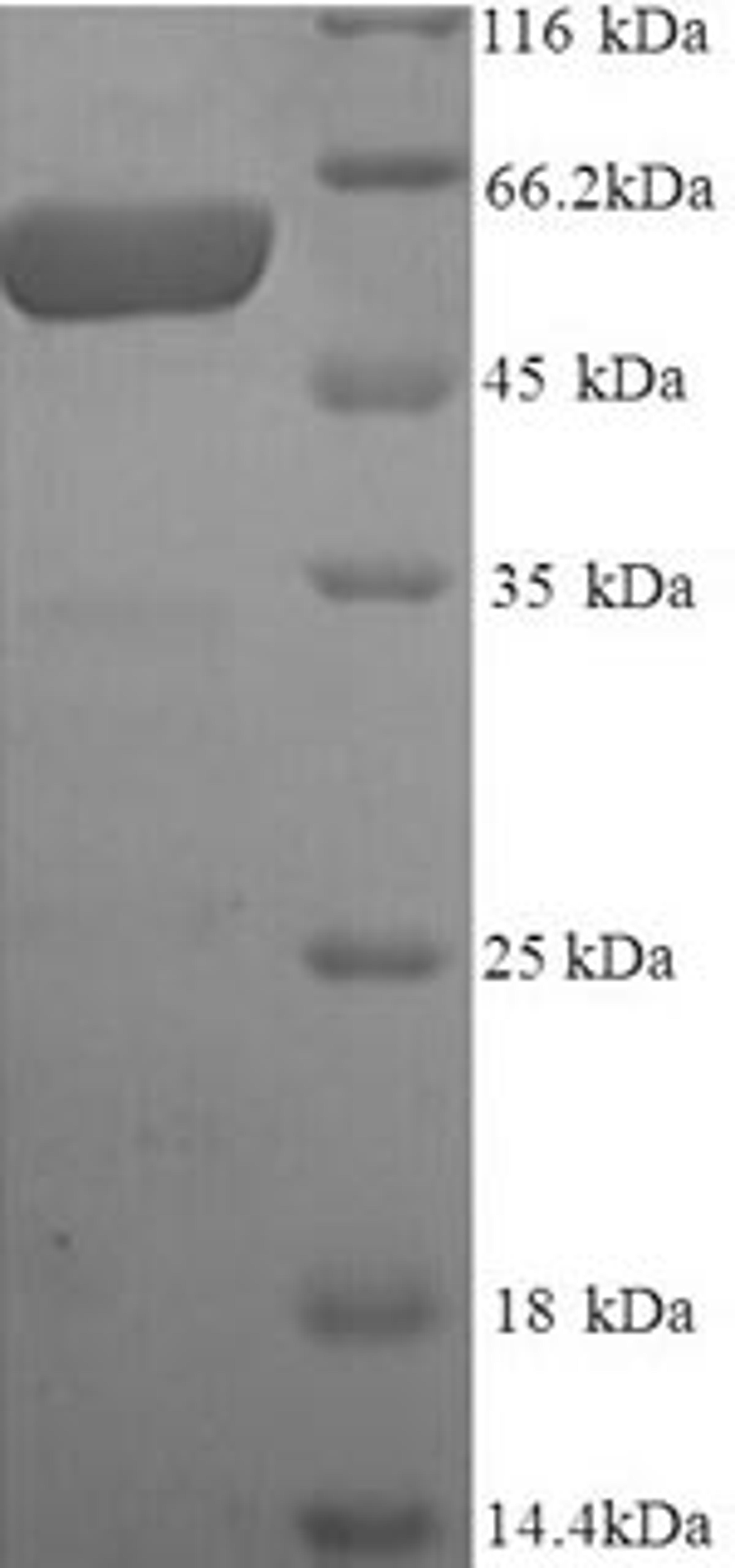 (Tris-Glycine gel) Discontinuous SDS-PAGE (reduced) with 5% enrichment gel and 15% separation gel.