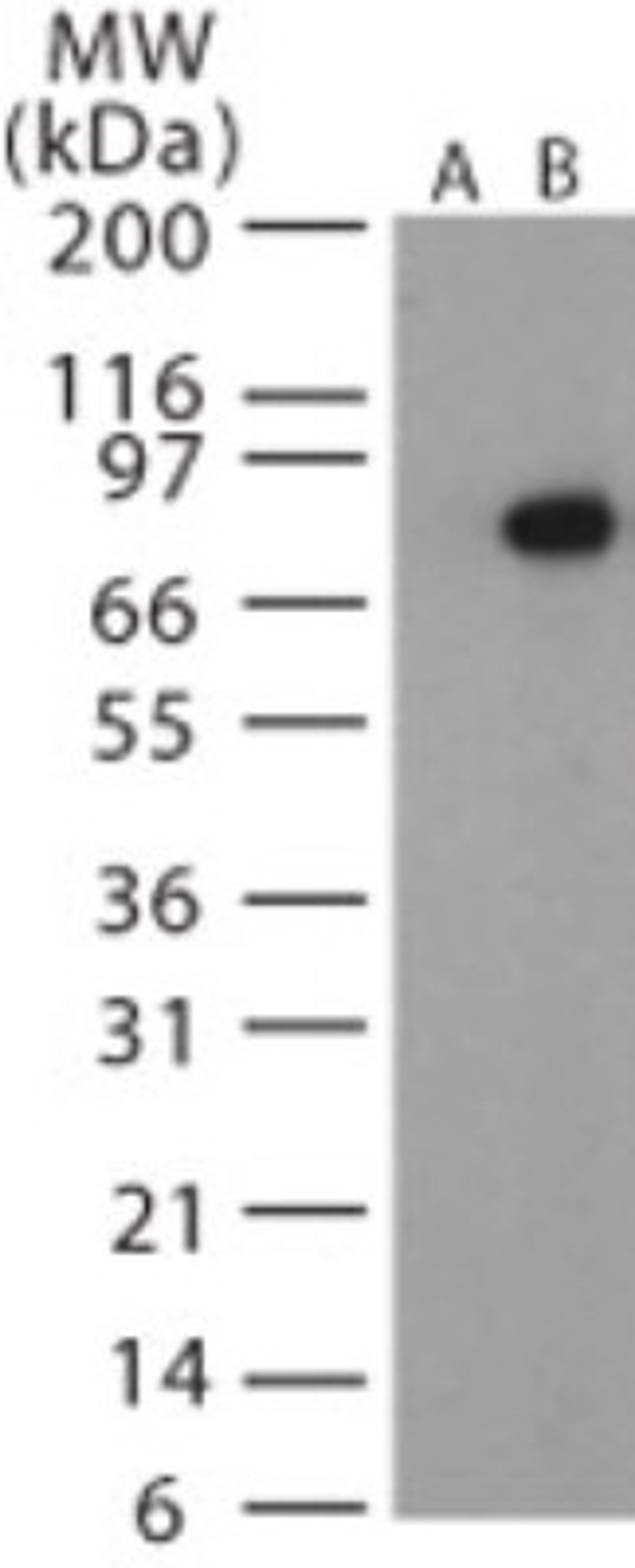 Western Blot: Bacillus anthracis protective antigen Antibody [NB120-13808] - Analysis of Bacillus anthracis protective antigen in recombinant protein using Bacillus anthracis protective antigen antibody (Lane B) at 1:1000 dilution. Lane A shows the pre-bleed.