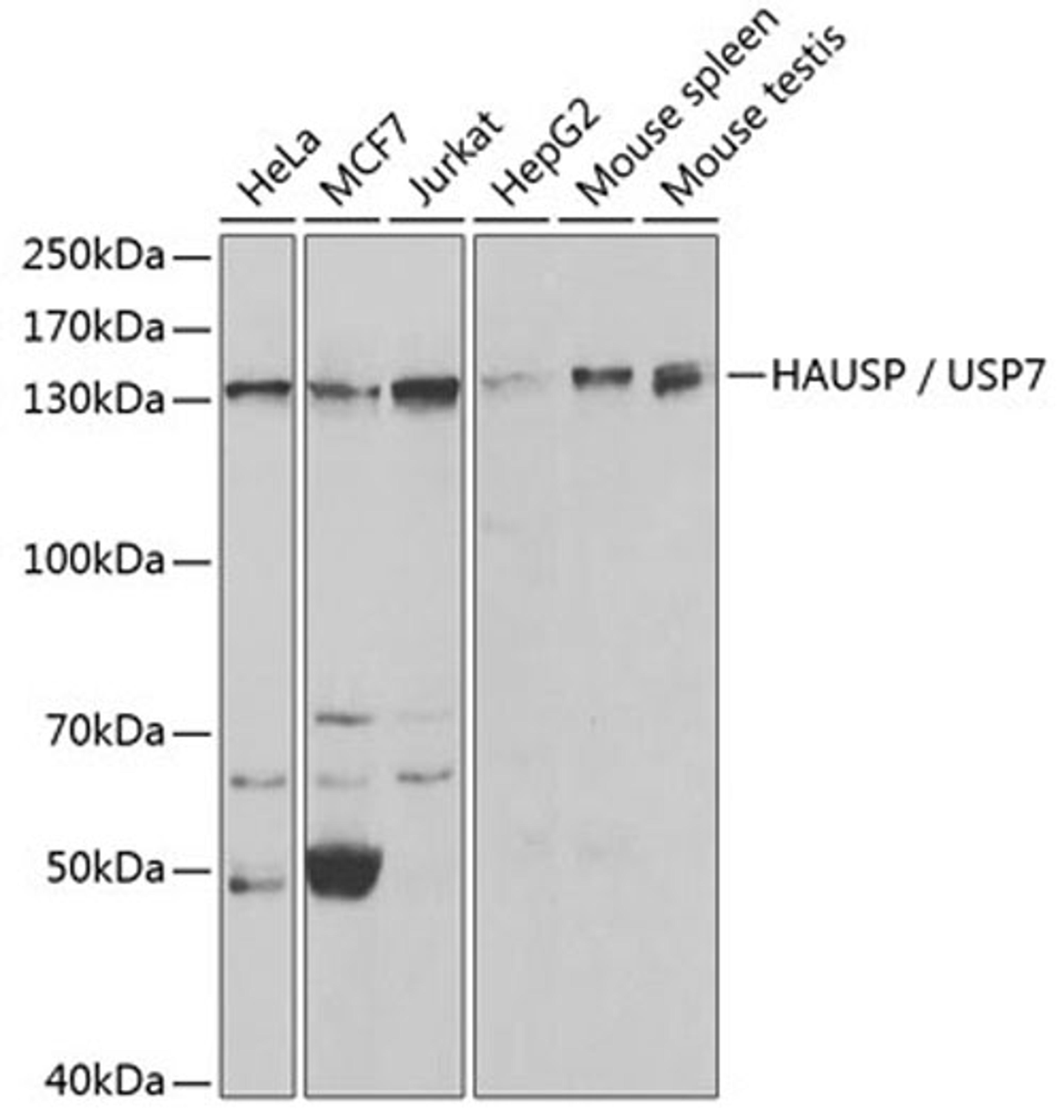 Western blot - HAUSP / USP7 antibody (A2345)