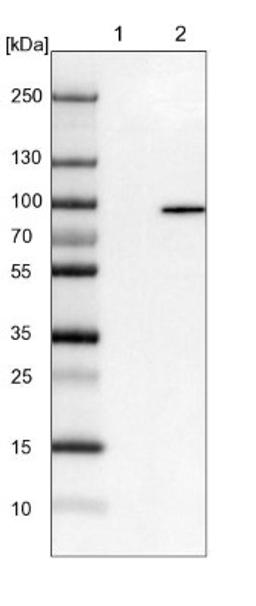 Western Blot: EPS8L2 Antibody [NBP1-83613] - Lane 1: NIH-3T3 cell lysate (Mouse embryonic fibroblast cells)<br/>Lane 2: NBT-II cell lysate (Rat Wistar bladder tumour cells)