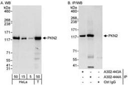 Detection of human PKN2 by western blot and immunoprecipitation.